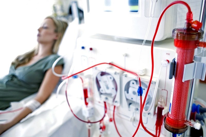 Hemodoialysis-Urology