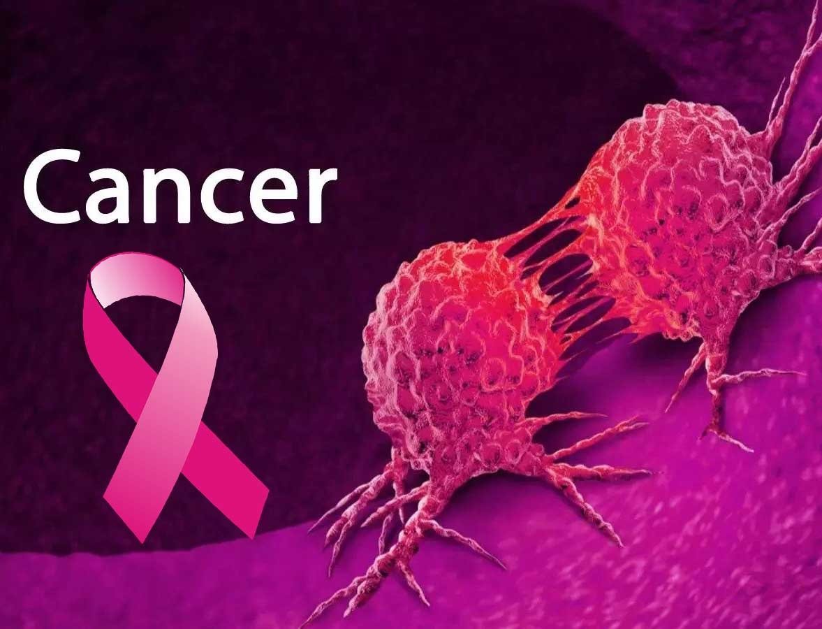 Best Cancer Doctor In Sagar