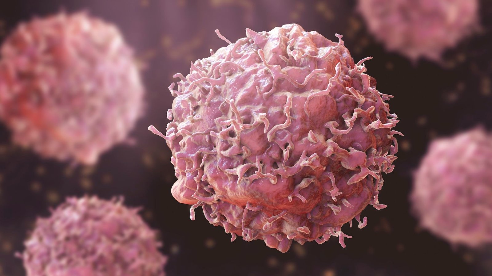 Best Cancer Doctor in Nagpur