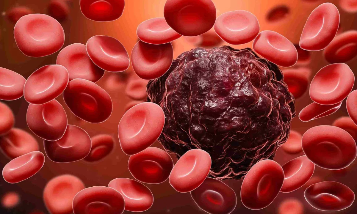 Blood Cancer Treatment In Nagpur