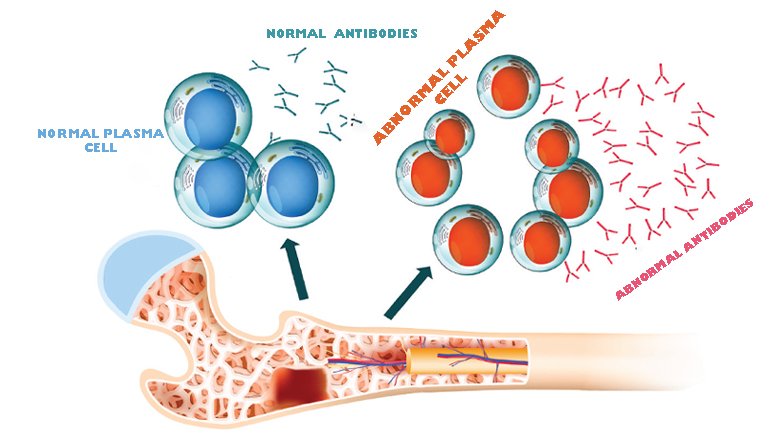 Blood Cancer Treatment In satna