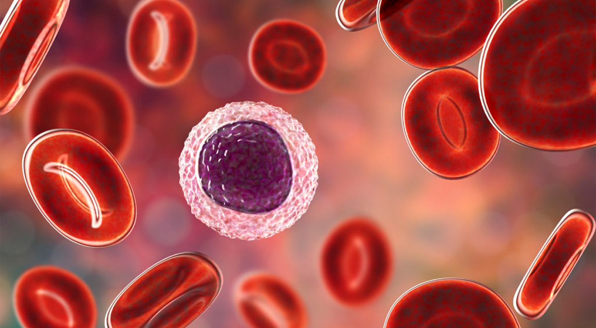 Blood Cancer treatment In Betul