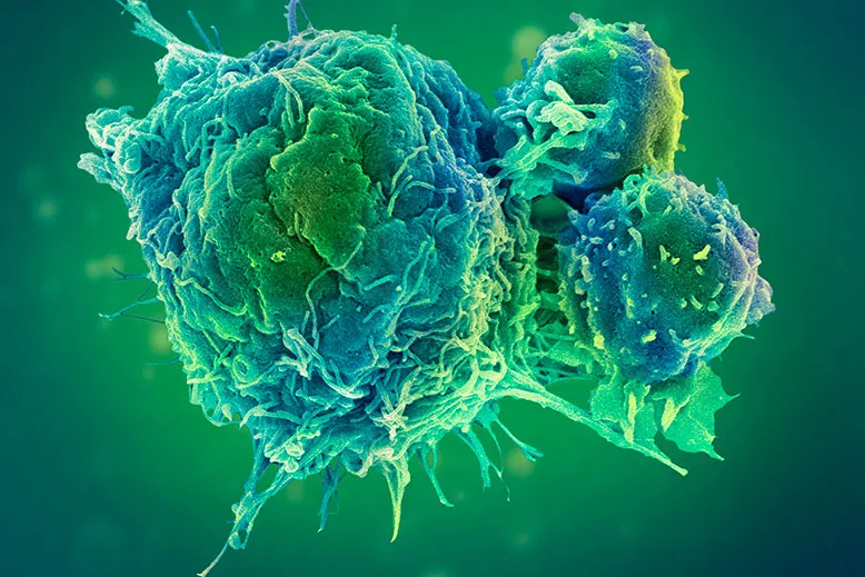 Oncology Specialist In Itarsi